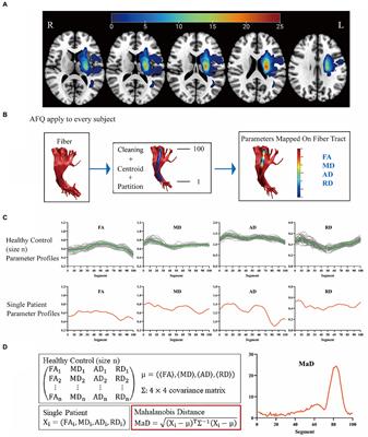 A normative modeling approach to quantify white matter changes and predict functional outcomes in stroke patients